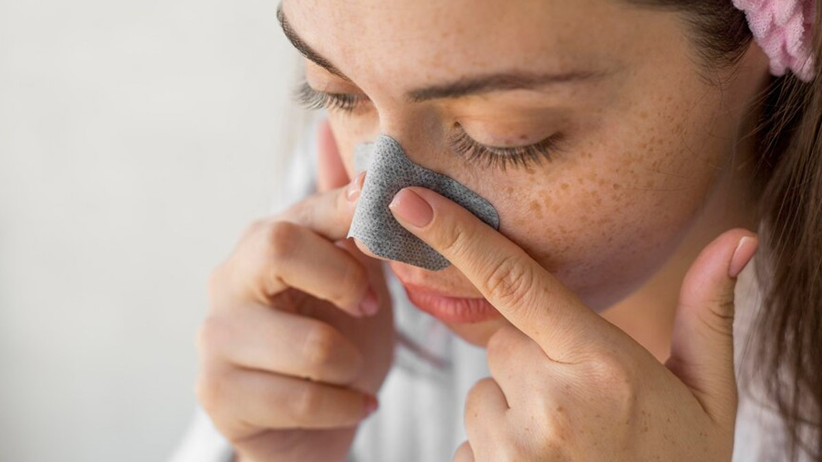 Blackheads On Nose Can Be Embarrassing: Follow These Tips To Remove It 